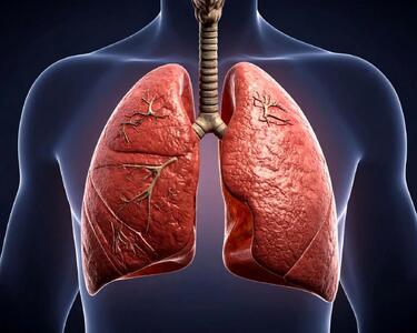 نشانه‌های سرطان مرگباری که زنان را بیشتر تهدید می‌کند