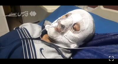 ایستادگی پلیسی که اغتشاشگران صورتش را به آتش کشیدند | جهان نیوز